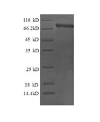SDS-PAGE - Recombinant Human Calpain 2 protein (His tag) (AB231157)