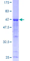 SDS-PAGE - Recombinant Human Calpain 3 protein (AB114576)