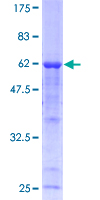 SDS-PAGE - Recombinant Human Calpain 3 protein (GST tag N-Terminus) (AB114576)