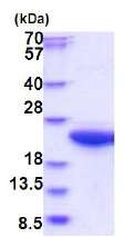 SDS-PAGE - Recombinant Human Calpain small subunit 1 protein (AB180298), expandable thumbnail
