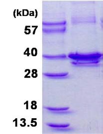 SDS-PAGE - Recombinant Human Calponin 1 protein (His tag C-Terminus) (AB128457)