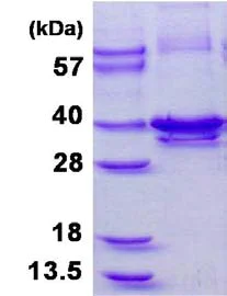 SDS-PAGE - Recombinant Human Calponin 1 protein (His tag C-Terminus) (AB128457)