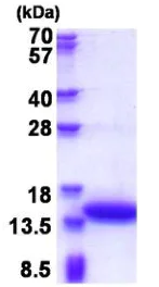 SDS-PAGE - Recombinant Human Calponin 2 protein (AB177711)