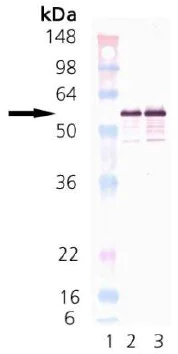 Western blot - Recombinant Human Calreticulin protein (AB91577)