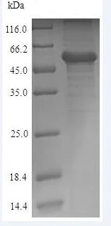 SDS-PAGE - Recombinant Human Calreticulin protein (His tag) (AB235685)