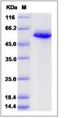 SDS-PAGE - Recombinant Human Calreticulin protein (His tag) (AB276554)
