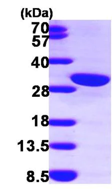 SDS-PAGE - Recombinant Human Calretinin protein (His tag N-Terminus) (AB100941)