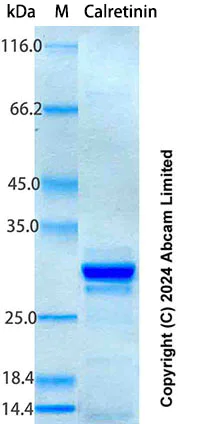 SDS-PAGE - Recombinant Human Calretinin Protein Standard (His tag) (AB316619)