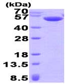 SDS-PAGE - Recombinant Human Calsequestrin 2 protein (His tag N-Terminus) (AB93736)