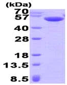 SDS-PAGE - Recombinant Human Calsequestrin 2 protein (His tag N-Terminus) (AB93736)