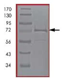 SDS-PAGE - Recombinant human CaMKII delta protein (AB84552)