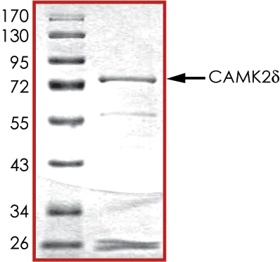 SDS-PAGE - Recombinant human CaMKII delta protein (AB84552)