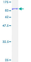 Recombinant human CamKII gamma protein