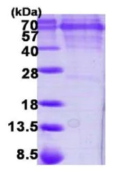 SDS-PAGE - Recombinant Human CAMKIV protein (His tag N-Terminus) (AB119450)