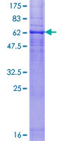 SDS-PAGE - Recombinant Human Cannabinoid Receptor II protein (GST tag N-Terminus) (AB114225)