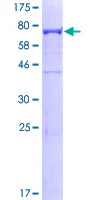 SDS-PAGE - Recombinant Human CAP1 protein (AB161016)