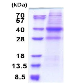 SDS-PAGE - Recombinant Human CAPZA2 protein (denatured) (His tag N-Terminus) (AB171494)