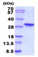 SDS-PAGE - Recombinant human Carbonic Anhydrase 1/CA1 protein (His tag N-Terminus) (AB208320)