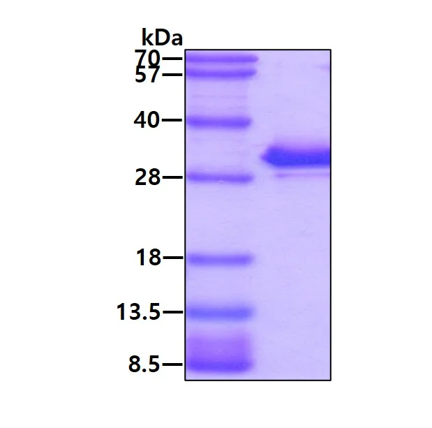 SDS-PAGE - Recombinant Human Carbonic Anhydrase 1/CA1 protein (His tag N-Terminus) (AB89359)