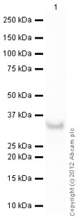 Western blot - Recombinant Human Carbonic Anhydrase 1/CA1 protein (His tag N-Terminus) (AB89359)