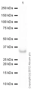 Western blot - Recombinant Human Carbonic Anhydrase 1/CA1 protein (His tag N-Terminus) (AB89359)