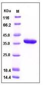 SDS-PAGE - Recombinant Human Carbonic anhydrase 10/CA10 protein (His tag) (AB276303), expandable thumbnail