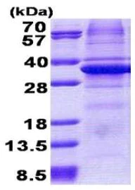 SDS-PAGE - Recombinant Human Carbonic Anhydrase 11/CA11 protein (denatured) (His tag N-Terminus) (AB167858)