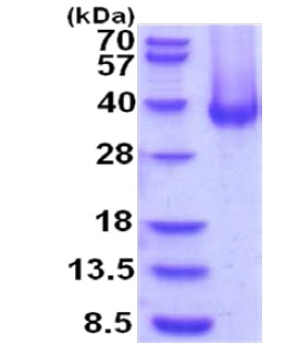 SDS-PAGE - Recombinant Human Carbonic Anhydrase 12/CA12 protein (His tag C-Terminus) (AB201875)