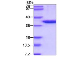 SDS-PAGE - Recombinant Human Carbonic Anhydrase 13/CA13 protein (His tag N-Terminus) (AB202181)