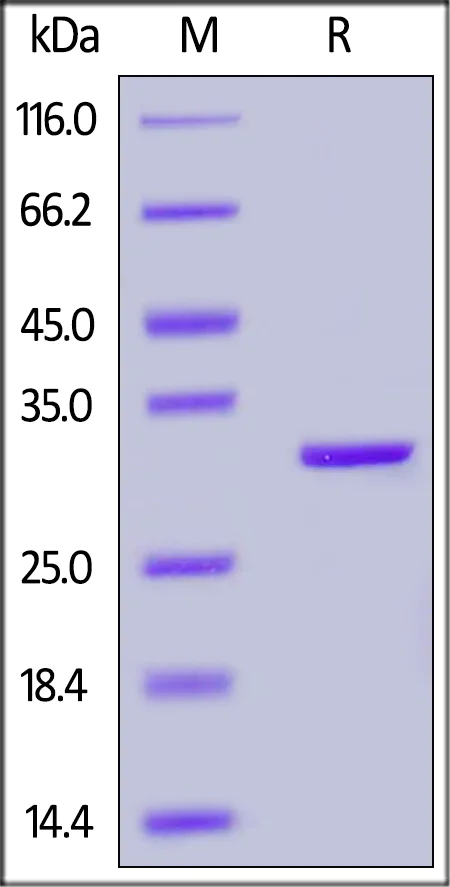 SDS-PAGE - Recombinant Human Carbonic anhydrase 2/CA2 protein (His tag) (AB167716)