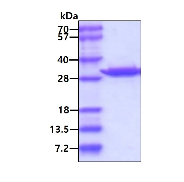 SDS-PAGE - Recombinant Human Carbonic anhydrase 2/CA2 protein (Tag Free) (AB85484)