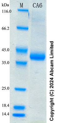 SDS-PAGE - Recombinant Human Carbonic Anhydrase 6 (CA6) Protein Standard (His tag) (AB316450)