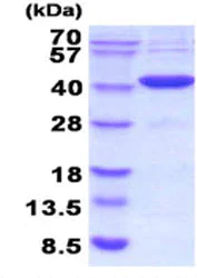 SDS-PAGE - Recombinant human Carbonic Anhydrase 8/CA8 protein (His tag N-Terminus) (AB208301)