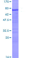 Recombinant Human Carbonic Anhydrase 9/CA9 protein