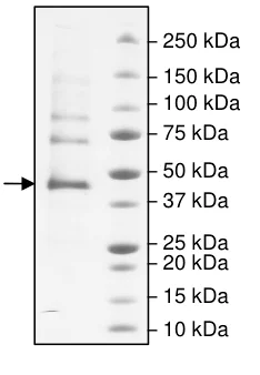 SDS-PAGE - Recombinant human Carbonic Anhydrase 9/CA9 protein (Active) (AB198056)