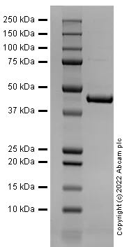SDS-PAGE - Recombinant Human Carbonic Anhydrase 9 / CA9 Protein (Active) (AB290062)