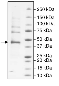 SDS-PAGE - Recombinant human Carbonic Anhydrase 9/CA9 protein (Active) (His tag C-Terminus) (AB198056)