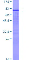 SDS-PAGE - Recombinant Human Carbonic Anhydrase 9/CA9 protein (GST tag N-Terminus) (AB114200)