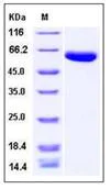 SDS-PAGE - Recombinant Human Carboxypeptidase B2 protein (His tag) (AB276397)
