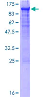 SDS-PAGE - Recombinant Human Carcino Embryonic Antigen CEA protein (AB158095)