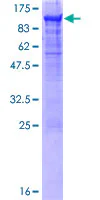 SDS-PAGE - Recombinant Human Carcino Embryonic Antigen CEA protein (GST tag N-Terminus) (AB158095)