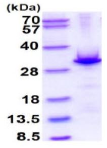 SDS-PAGE - Recombinant Human Cardiac Troponin I protein (AB283299), expandable thumbnail