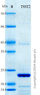 SDS-PAGE - Recombinant Human Cardiac Troponin T Protein Standard (His tag) (AB316587), expandable thumbnail