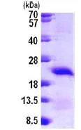 SDS-PAGE - Recombinant Human CARHSP1 protein (His tag N-Terminus) (AB101171)