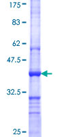 Recombinant Human CARM1 protein