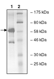 Recombinant human CARM1 protein