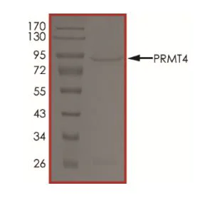 SDS-PAGE - Recombinant human CARM1 protein (Active) (AB268888)