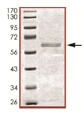 SDS-PAGE - Recombinant human Casein Kinase 1 alpha protein (AB102102)