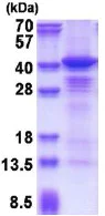 SDS-PAGE - Recombinant Human Casein Kinase 1 alpha protein (denatured) (His tag N-Terminus) (AB177662)