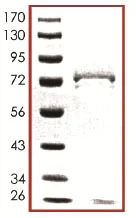 SDS-PAGE - Recombinant human Casein Kinase 1 delta/CSNK1D protein (AB103955)